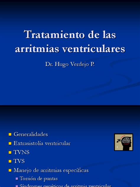 arritmias ventriculares tratamiento